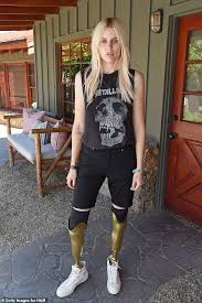 Model Who Lost Her Legs Says She S Training To Run The Nyc Marathon Amputee Model Amputee Model Woman Cute Country Girl