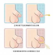 陰莖多長才正常？醫揭統計真相「小於○○公分」都算過短：最好快就醫|Uho優活健康網