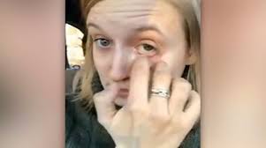 Worm in woman's eye leads to discovery