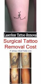 The ones that do, you can find in your towns phone directory. Pin On Tattoo Removal