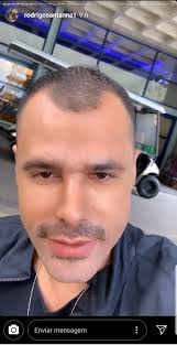 Tô confusa…, disse uma internauta. Dudu On Twitter Gente A Rinoplastia E Harmonizacao Do Rodrigo Santana