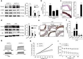Menyusun program bk (bimbingan dan konseling) bukan perkara mudah karena perlu assessment terlebih dahulu kemudian dianalisis dan program bk tersedia untuk semua jenjang pendidikan mulai smp, sma, dan smk. Activating Bk Channels Ameliorates Vascular Smooth Muscle Calcification Through Akt Signaling Acta Pharmacologica Sinica
