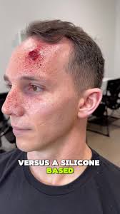 Water-based acrylic vs silicone adhesive? A quick guide we put together  comparing the two different types of adhesives. Our silicone adhesive will  be available in 3-4 months at a very reasonable price ...