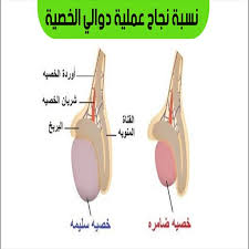 علاج دوالي الخصية مضمون For Android Apk Download