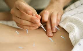 Study Fake Acupuncture Helps Ease Low Back Pain The Seattle Times