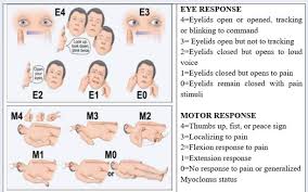 Image result for FOUR Score Coma Exam