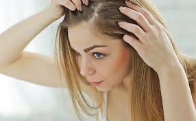 Can itchy scalp cause hair loss? What Causes Women S Hair Loss The Crown Clinic