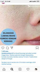 Tips Kecantikan Alami Tips Kecantikan Perawatan Kulit Perawatan Kulit Alami Produk Perawatan Kulit