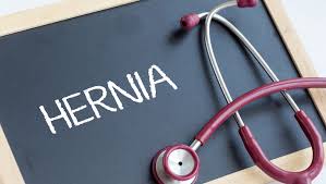 Dry your groin area well after a shower, you may make use of a blow dryer for the same, make sure you set it on a dust your groin area with an anti fungal powder. Hernia Pain And Potential Complications Beaumont Health
