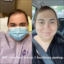 See more ideas about transgender mtf, mtf transition, transgender women. 51ub4mvo3gvkhm