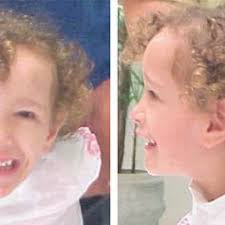 Typical Sotos facial gestalt of patient 4 at the age of three years.