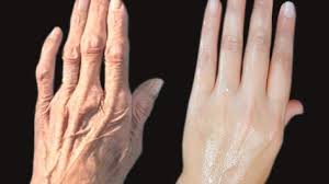 How To Remove Wrinkles On Your Hands Clear The Hand Roughness And Dryness Wrinkle Wrinklyhands Handwrinkle Handwri Wrinkles Hands Wrinkle Remover Wrinkles
