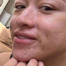 TOP 10 BEST Skincare Facial in Chino, CA