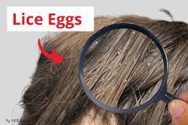 If a fabric item cannot be washed or taken to a dry cleaner, seal it in a plastic bag, and store it for two weeks. Dead Vs Live Nits Color Of Lice Eggs My Lice Advice