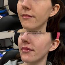 Leah Wheaton MSN,FNP-C (@leahwheaton_np) • Instagram photos and videos