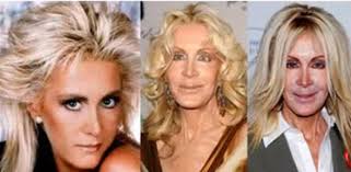 Such plastic surgery nightmares can destroy a celebrity's career in showbiz. 17 Celebrity Before And After Plastic Surgery Disasters