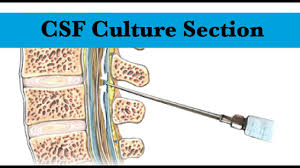 Image result for CSF Culture