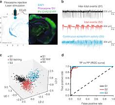 Kcc2 Overexpression Prevents The Paradoxical Seizure