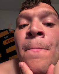 Mustache 4 Kids Progress!! ———————————————————————————————————— UNL Rugby  has partnered up with Mustache 4 Kids fundrasing campaign to help support  the Collective For Hope! The Collective For Hope is a therapeutic grief  organization