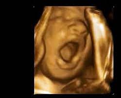 Check spelling or type a new query. 3d Ultrasound 30 Weeks Yawning Baby A New Conception 3d Video Dailymotion