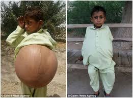 Vertbaudet, spécialiste mode chic & pratique pour les enfants et pour les parents. Ce Garcon De 9 Ans Souffre D Une Maladie Rare Qui Le Laisse Avec Le Ventre Ballonne Photos Afrikmag