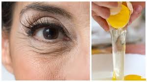 Goz Alti Kirisikliklari Nasil Giderilir Sosyola