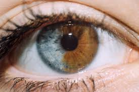 Are Purple Eyes Real Is Alexandria S Genesis A Fact The Eye News