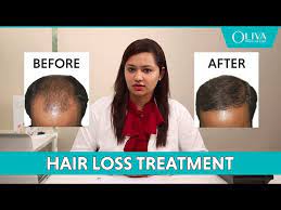 Vitamin d is critical to preventing hair loss. List Of Medications Or Drugs That Can Cause Hair Loss