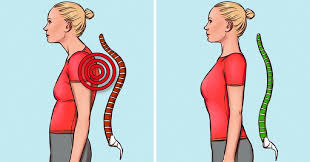 Learn about how to overcome kyphosis and other types of sagging. 8 Simple Exercises To Improve Your Posture And Reduce Back Pain