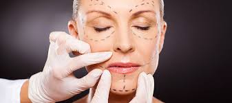 Scarlet S (Ameliyatsız Yüz Germe)