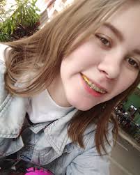 X-এ Alecia Andersen: "กว่าจะเลือกใส่สีนี้คิดนานอยู่พอสมควร  เราว่าก็โอเคน้ะส่วนตัวเราชอบสีเหลืองด้วย 💛 #ยางจัดฟัน #จัดฟัน #สีเหลือง  https://t.co/LleLoMBMZC"