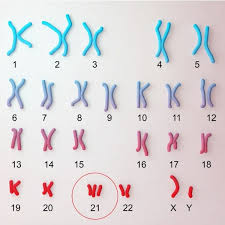 Karyotyping is a lab procedure that helps your doctor examine your chromosomes. Meiosis Mistakes Let S Talk Science