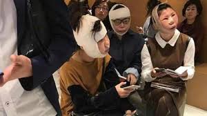 Hasil gambar untuk foto Operasi Plastik Di Korea Sudah Melewati Batas Umum