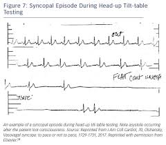Image result for Syncope