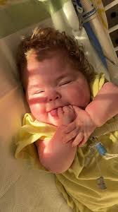 Sunshine coming in this morning ☀️ Teddy had a DLB this morning and rhey  removed a good amount of granulation tissue inside her airway, they said it  was obstructing it pretty well,