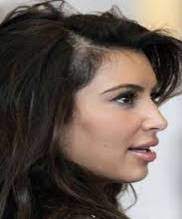 What's causing your hair loss? Hair Loss In Women The Balding Truth Beautyfeatures Ie