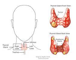 For thyroid cancer, this staging system differs by tumor type. All About Thyroid Cancer Oncolink