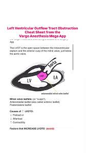 Image result for Left Ventricular Outflow Obstruction