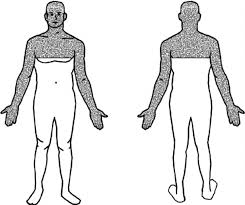 Image result for Anhidrosis