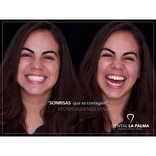 Dental La Palma