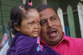 Jennifer Moreno Dixon, se despidio hoy de Bluefields. Desde ahora la vida  de Jennifer, podría cambiar, Victor Rosales, mejor conocido como el Santa  Claus Nica, vino hasta Bluefields a buscar a Jennifer