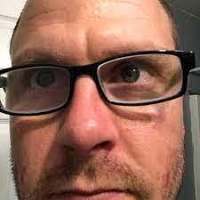 Jared Tuck's Instagram, Twitter & Facebook