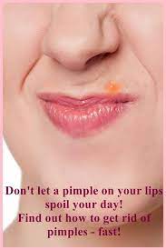 How To Treat Lip Pimples Helpful Skincare Advice How To Get Rid Of Acne Back Acne Treatment Pimples