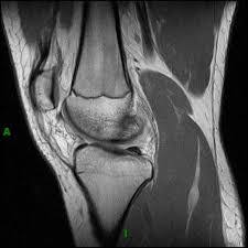 Nur die beine im mrt untersucht werden. Mrt Knie Radtop De Praxis Fur Radiologie Neuroradiologie Dr Topcu Kollegen