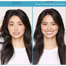 Shampoos, scale softeners, and other treatments. Living Proof Scalp Care Dry Scalp Treatment Ulta Beauty