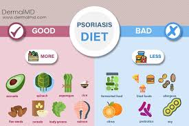 Psoriasis Diet Chart Which Every Psoriasis Patient Should