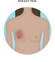 The precise causes of breast cancer are unclear, but we know the main risk factors. Breast Pain National Breast Cancer Foundation