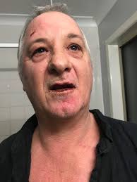 Witnesses say Dylan Fogle, 25, was kicked out of the club for inappropriate  behavior and came back to drive the truck into people standing at the club  entrance