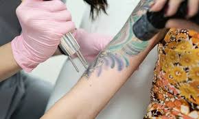 With premium tattoo removal's guaranteed low prices and special offers (such as multiple tattoo discounts), treatments can be as low as $49. Laseraway From 92 Groupon