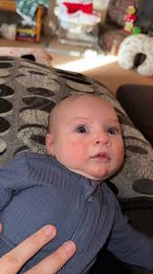 am having a heavy bleeding is it normal for a 5 month postpartum